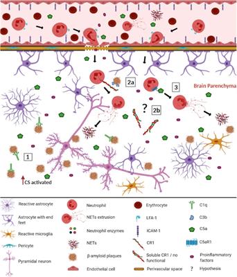 Neutrophil Extracellular Traps: A Perspective of Neuroinflammation and Complement Activation in Alzheimer’s Disease